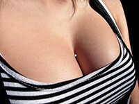 Microdermal voorbeeld