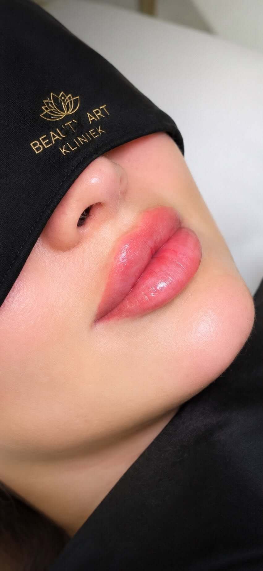 Lippenbehandeling Beauty Art Zoetermeer
